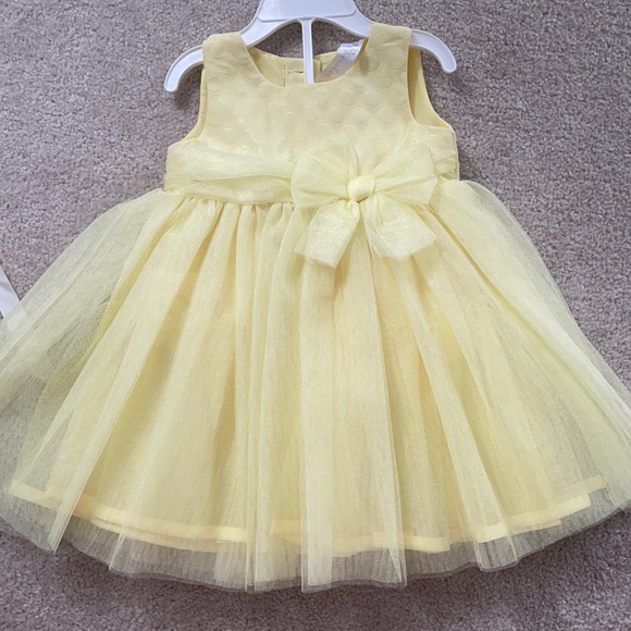 Dress bundle 👗 five dresses included! - Picture 3 of 6